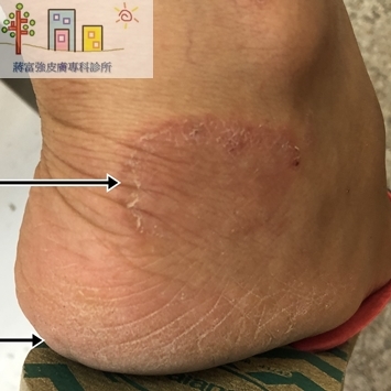 蔣富強皮膚專科診所